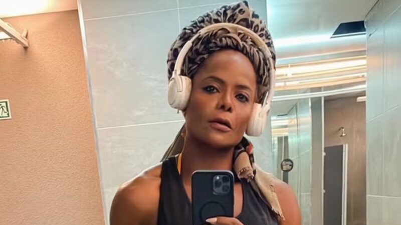 Adriana Bombom sofre queda de bicicleta em Ipanema e desabafa: ‘Cicatrizes’