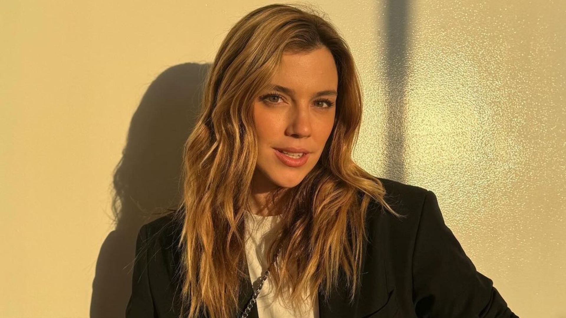 Alice Wegmann exibe resultado após retirada dos sisos e vira assunto: ‘Desarmonização facial’