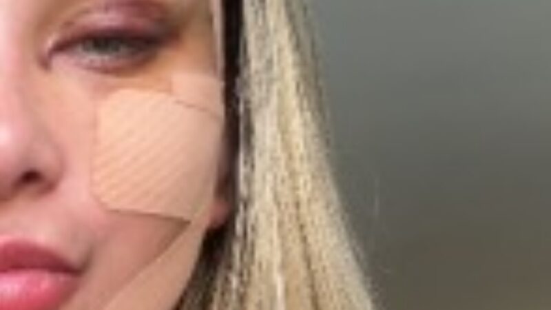 Andressa Urach passa por transformação e choca ao revelar novo procedimento