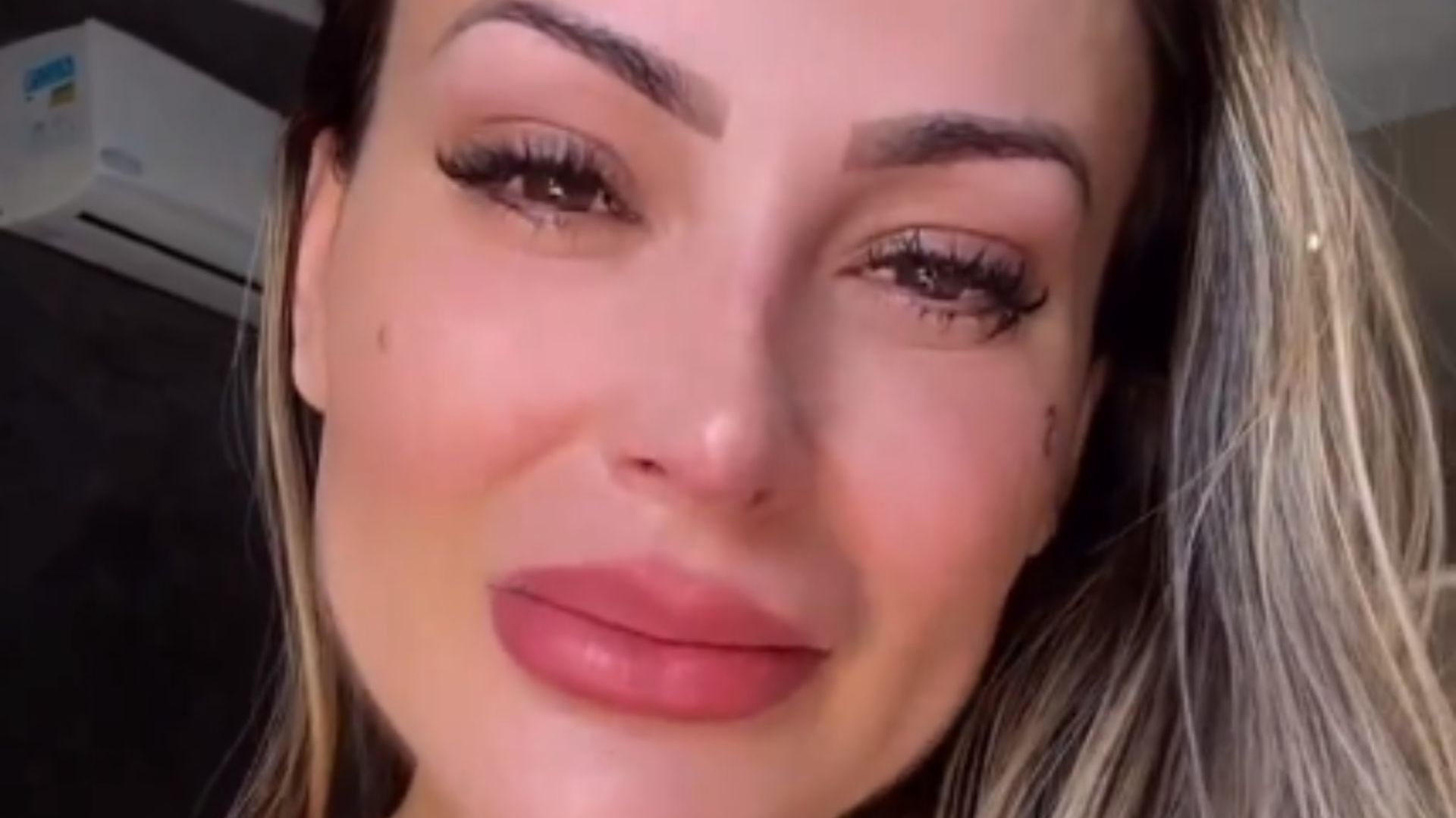 Andressa Urach vai parar no hospital e choca com revelação: ‘Mais de R$ 300 mil’