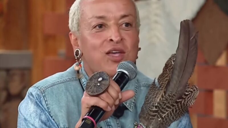 Antes e depois: Walério Araújo revela transformação facial após procedimentos estéticos