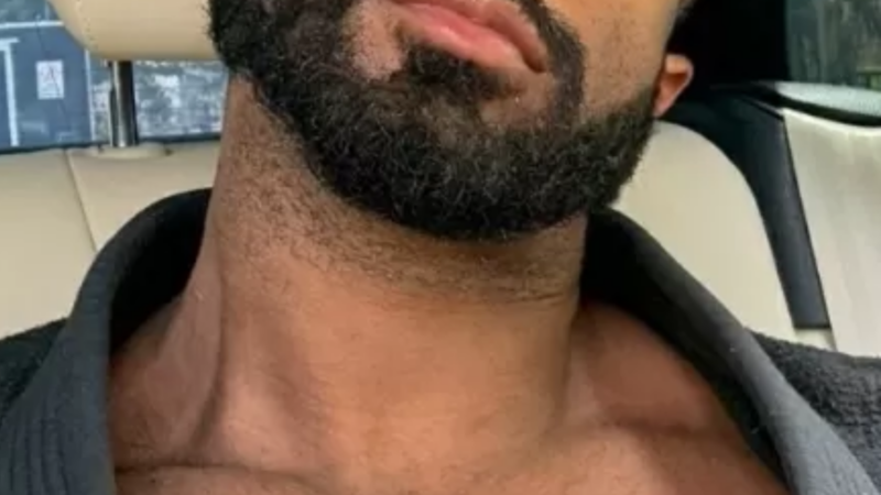 Cantor famoso revela antes e depois após perder 40 kg: ‘Tempo’