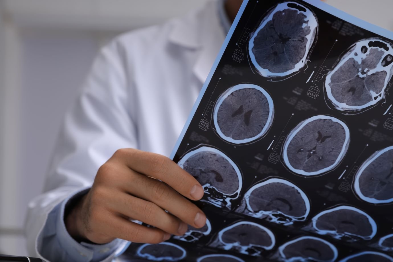 Cientistas descobrem que composto à base de cobre reduz proteína do Alzheimer e protege a memória