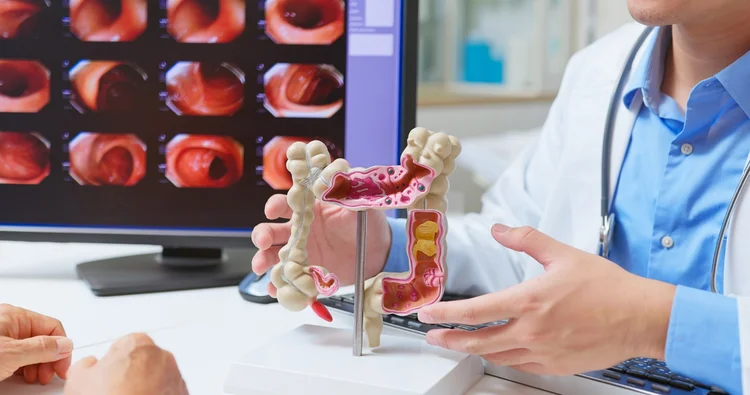 Cientistas descobrem tratamento que faz câncer de cólon 'sumir' antes da cirurgia