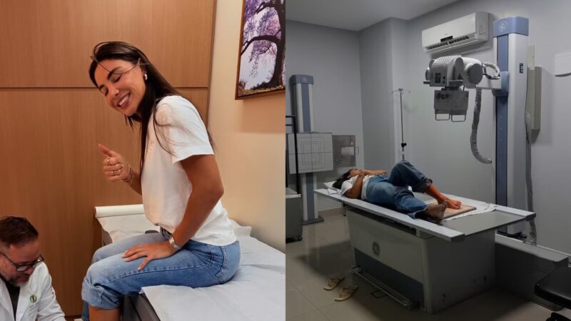 É grave? Gabriela Versiani sofre acidente doméstico e fratura o pé após infecção intestinal
