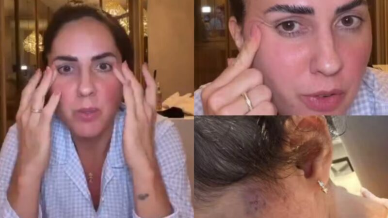 Esposa de Zezé Di Camargo, Graciele Lacerda revela procedimento da filha por causa de nódulos: ‘Chorar’