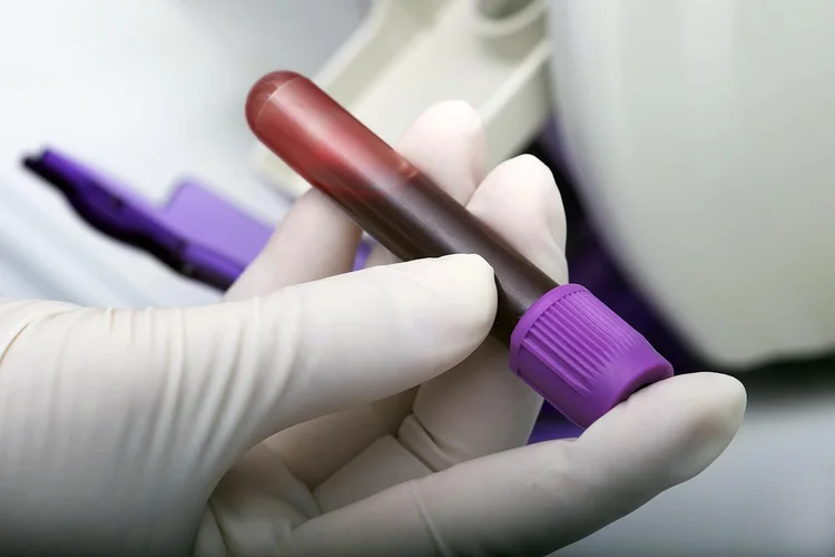 Exame de sangue de rotina pode prever risco de Alzheimer