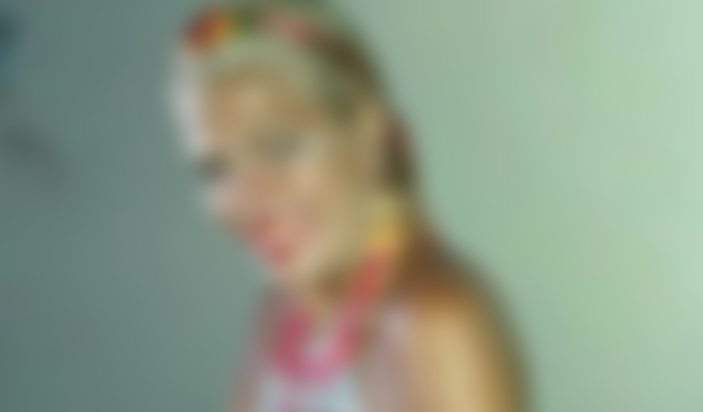 Famosa amputa braço e morre após ataque assustador de cachorro do próprio filho