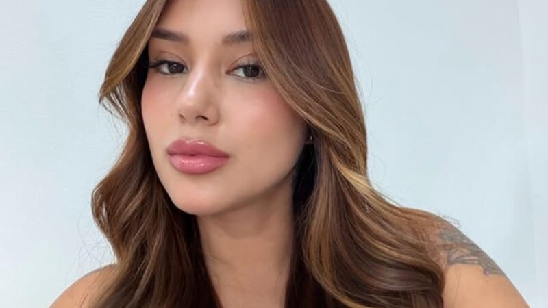 Famosa influenciadora choca ao mostrar necrose e deformações no corpo; veja