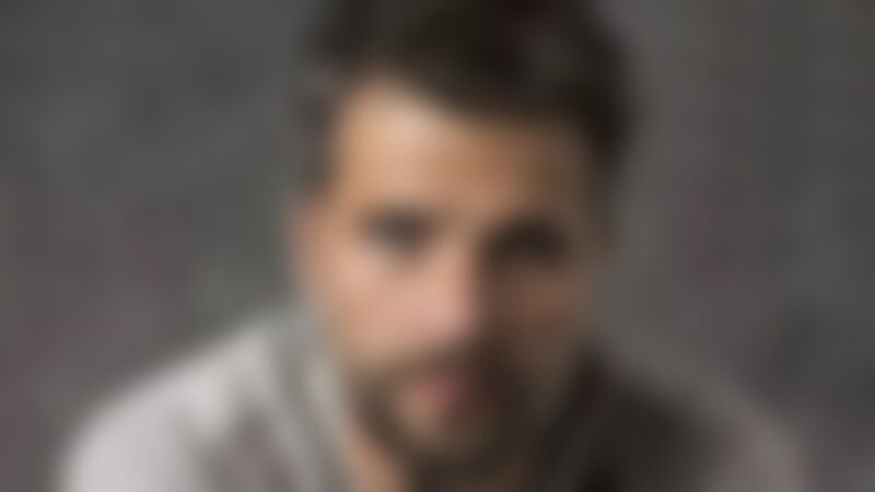 Galã perdeu parte do corpo e teve que fazer enxerto com região íntima: ‘Cheiro de…’