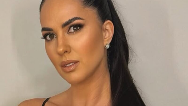 Graciele Lacerda choca com transformação radical do rosto após procedimentos