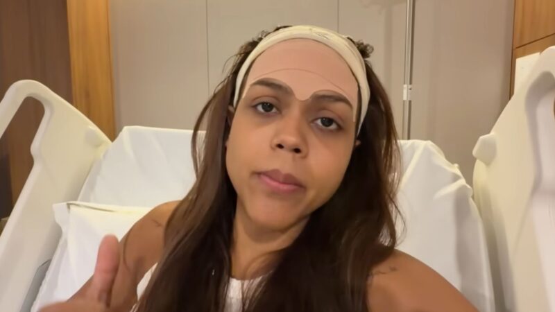 Igual à Anitta? Camila Loures faz cirurgia no rosto e revela detalhes de decisão