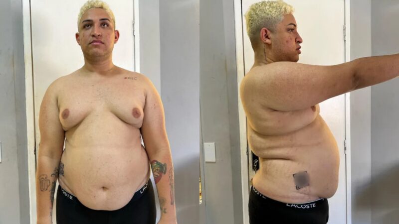 Influenciador perde quase 50 kg e aparece irreconhecível; veja