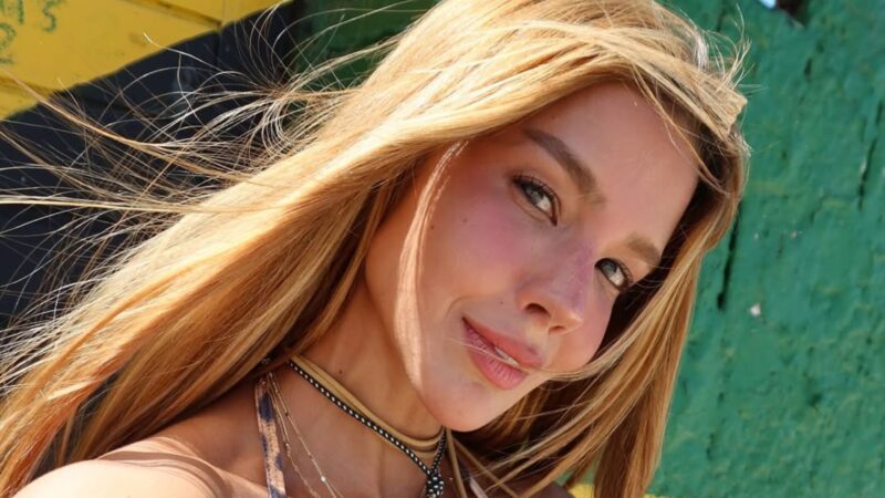 Inreconhecível? Ex-BBB Kerline choca com “novo rosto” e revela plásticas; confira antes e depois