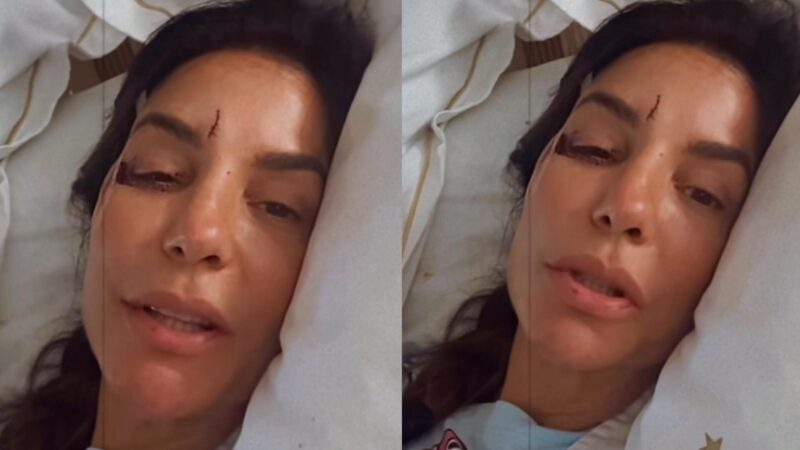 Internada, Ivete Sangalo aparece com rosto ferido e revela real estado de saúde