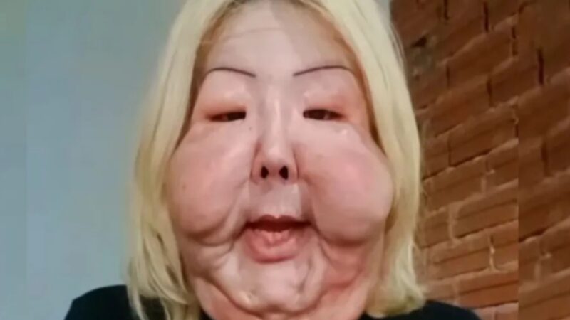 Juju do Pix recebe alta após implante de silicone nos seios: ‘Está babado’