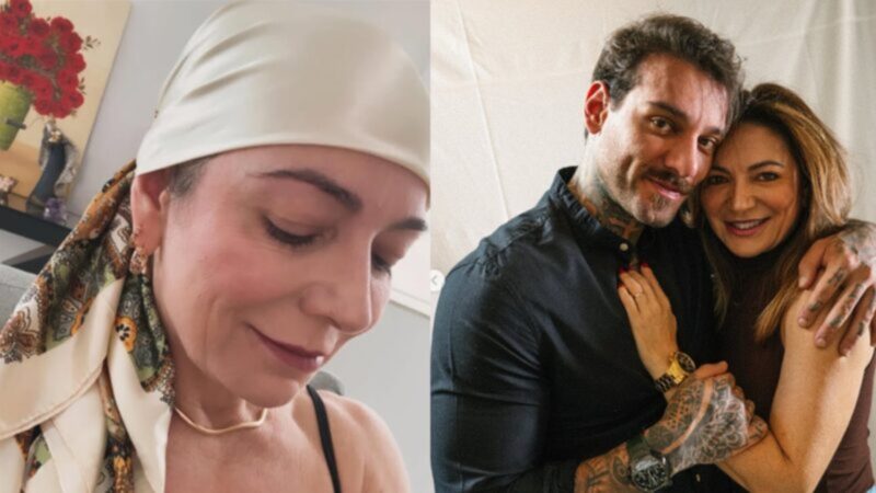 Karina Lucco revela os desafios da medicação durante tratamento de alopecia