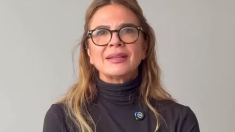 Luciana Gimenez desabafa sobre procedimentos estética e é criticada: ‘Faz vários’