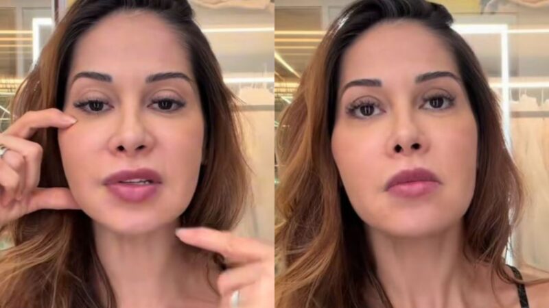 Maíra Cardi fará cirurgia para remover procedimento do rosto por risco de necrose; veja