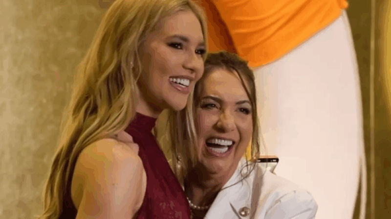 Mudou muito? Mãe de Virignia passa por transformação após procedimento estético