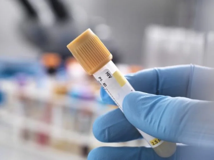 Por que uma conferência em Boston chama a atenção para o tratamento contra o HIV