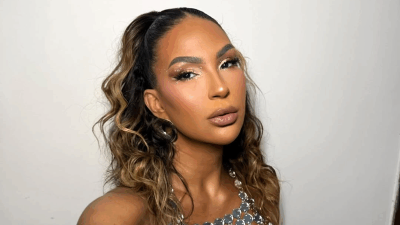 Valesca Popozuda é massacrada por exagerar na harmonização: ‘Trocou de rosto’