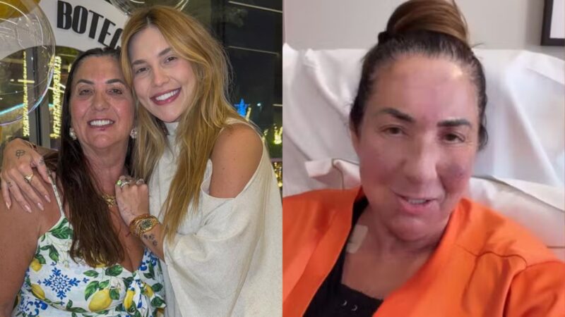 Virginia mostra antes e depois de Margareth após plásticas e web reage: ‘Dinheiro traz…’