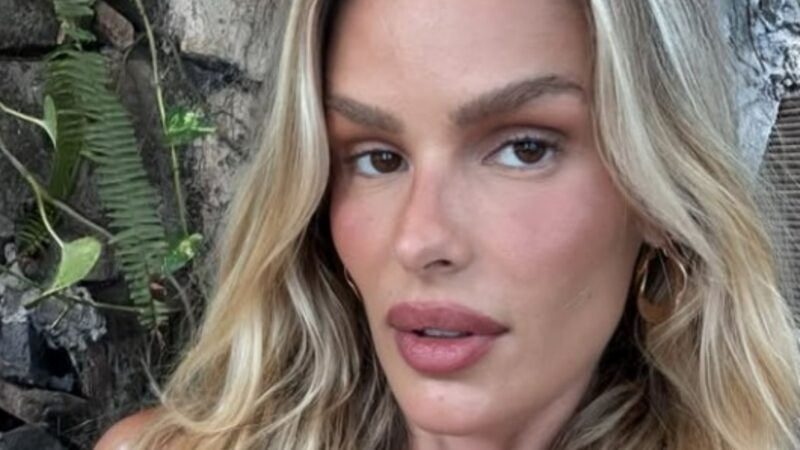 Yasmin Brunet comemora perda de 25 kg e mostra evolução do lipedema